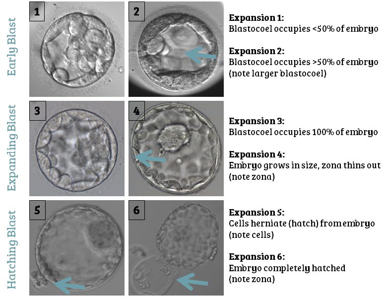 Embryo grade 1