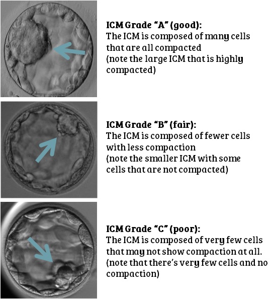 Embryo grade 2